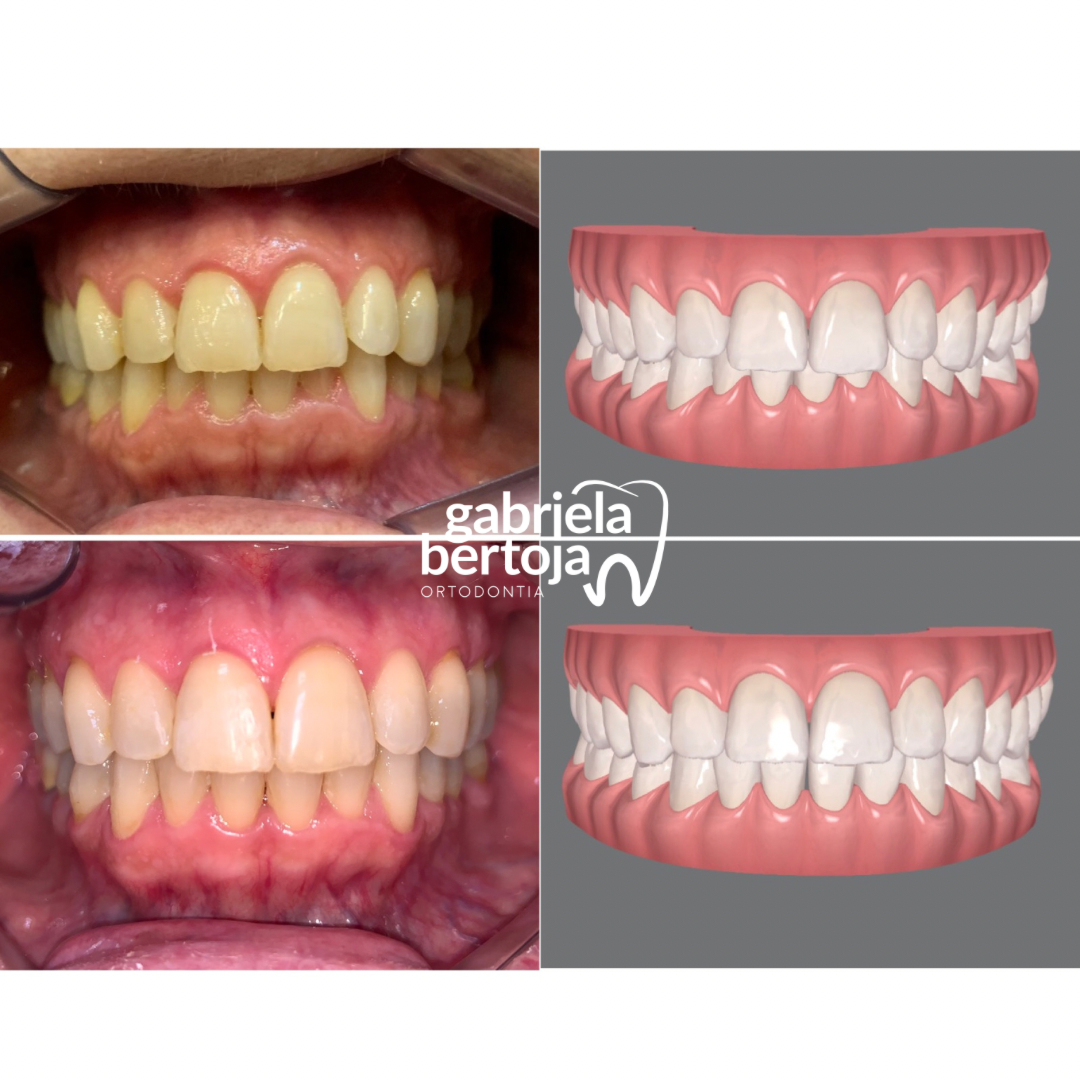 2B147FFC-2000-4E75-B5FE-FB4D1F01616E