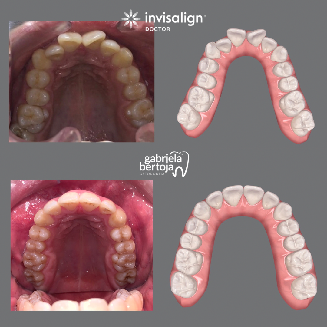 6DDC986E-2EB4-4D3A-B63C-BDE7B1BFAA42
