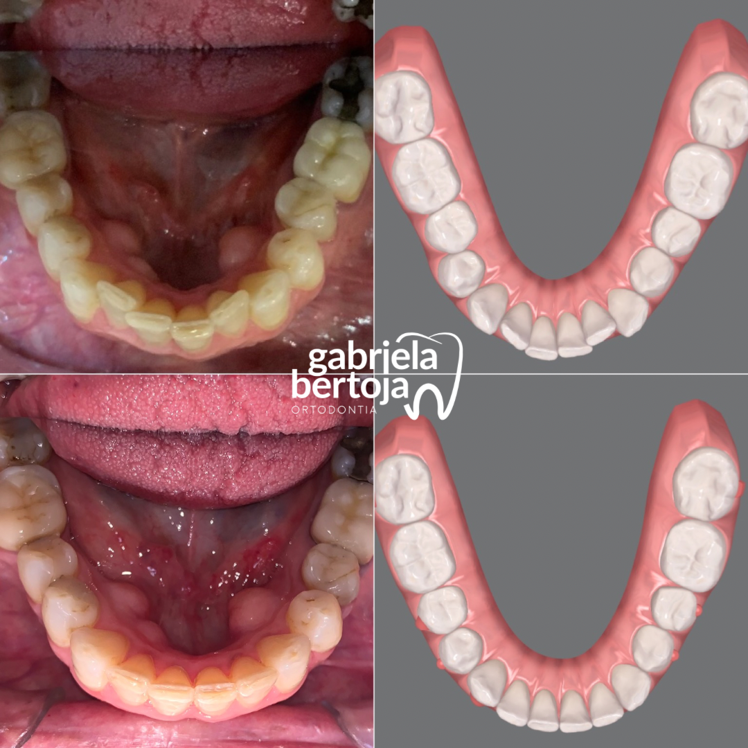 E4FDA585-3E2C-40A6-8BB5-B606C308A757